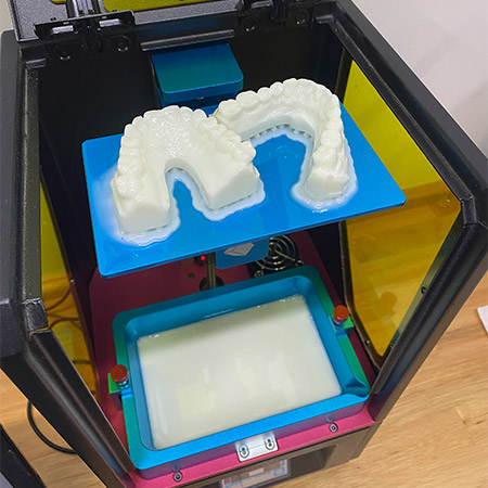 Impressão 3D de Prótese - Odontologia Koza