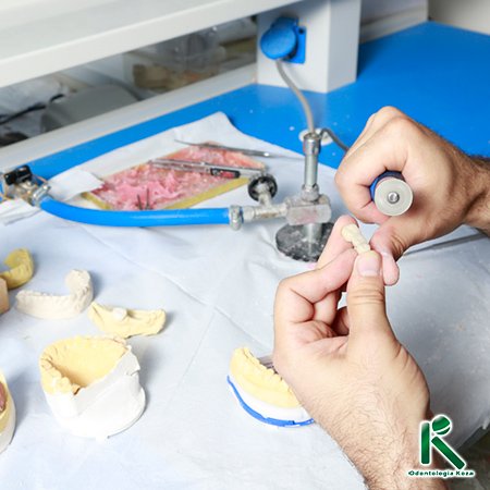 Impressão 3D de Prótese - Odontologia Koza