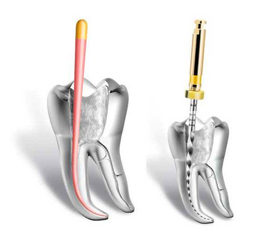 Foto Tratamento - Clinica Geral - Odontologia Koza