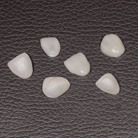 Foto Tratamento Lentes e Facetas Dental - Dra Juliana Montes - Odontologia